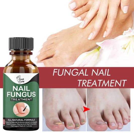 100% Original Nail Fungus Treatment Stop Fungal Growth Effective Fingernail 10ml